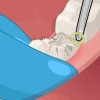 Operate Now! Dental Implant